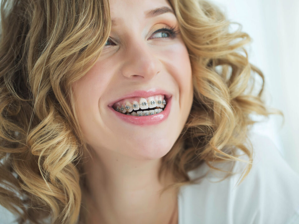 a smiling woman with braces
