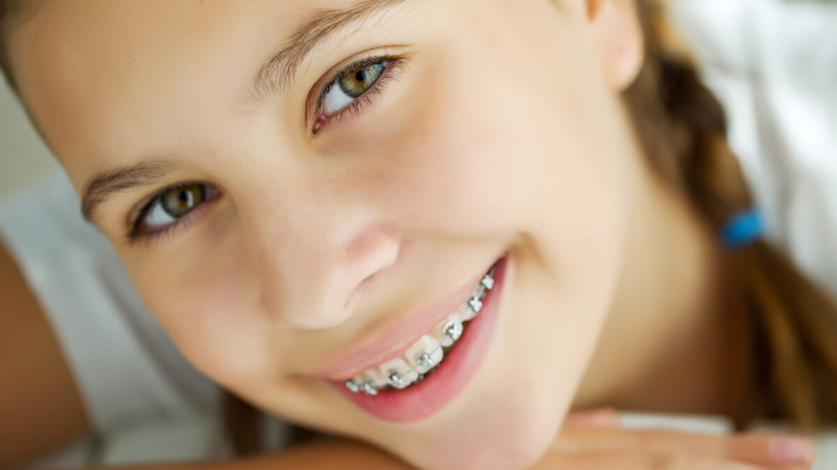 closeup picture of a girl with braces smiling