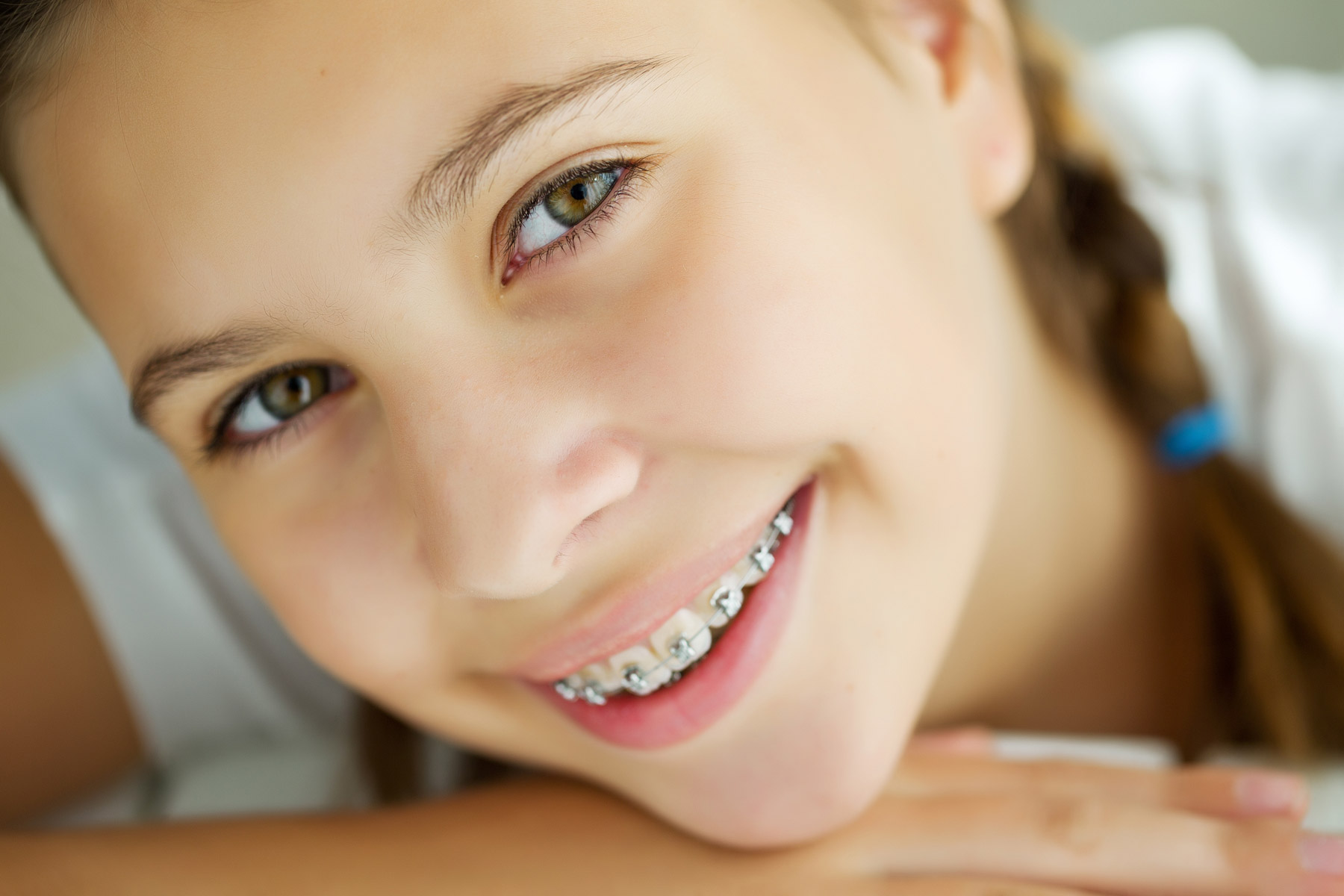 closeup picture of a girl with braces smiling