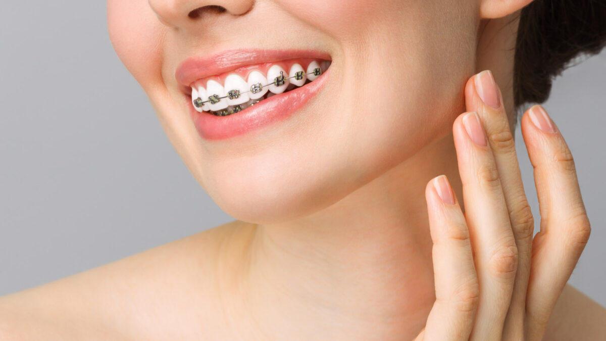 young female patient at Aria Dental Smiling with braces
