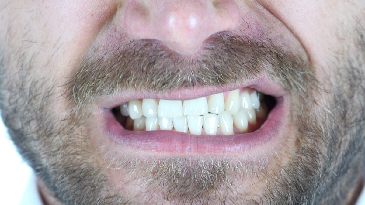 a man grinding his teeth
