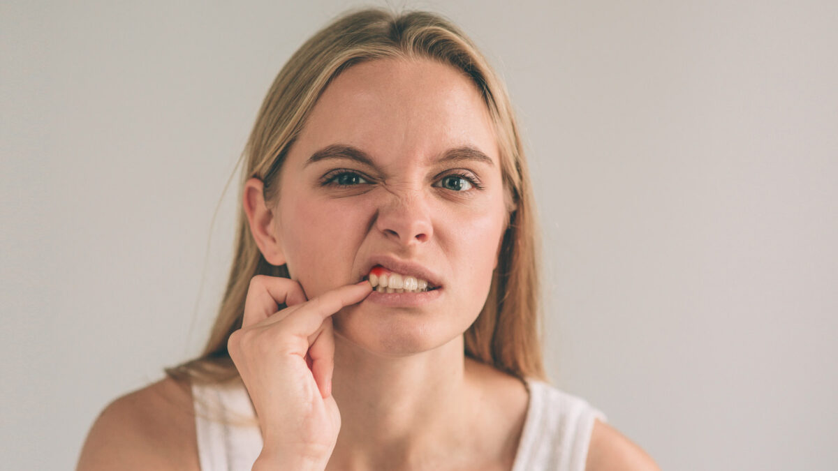 a woman with bleeding gums