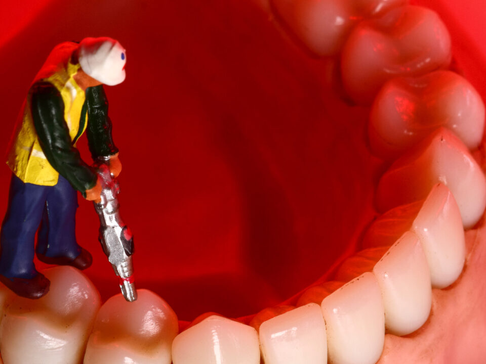 a miniature toy man drilling on a tooth