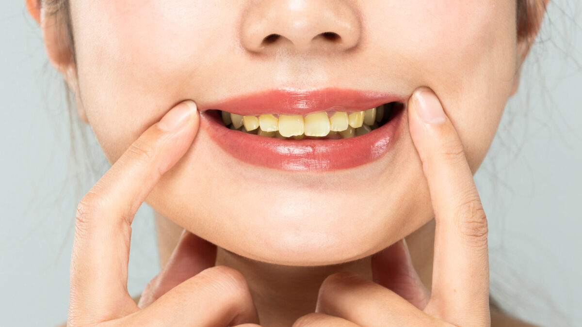 Why Should I Be Concerned About the Color of My Teeth?
