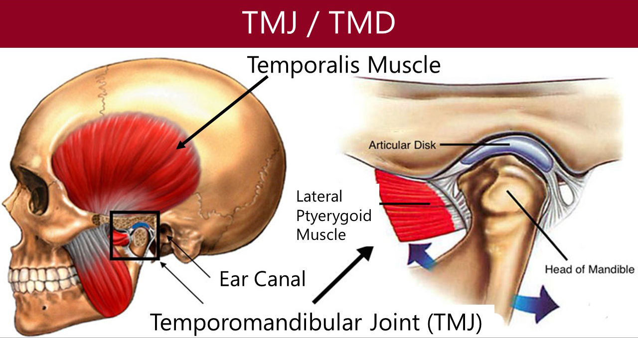 TMJ and TMD illustrated on human skull
