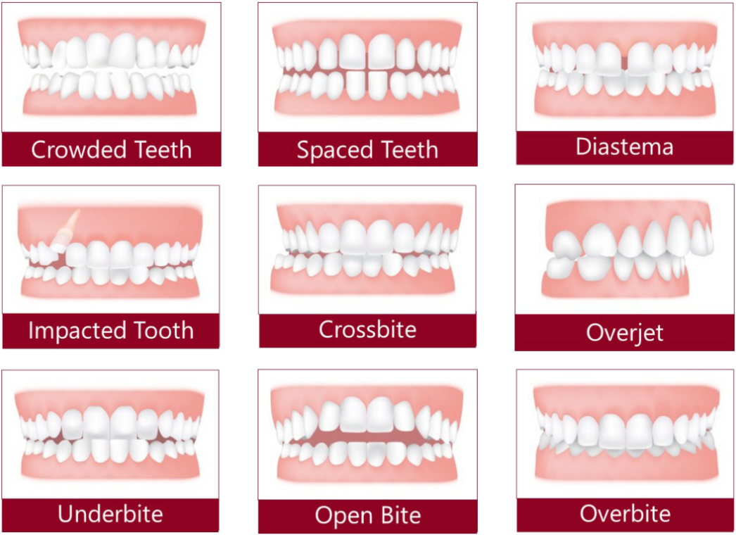 nine different forms of teeth