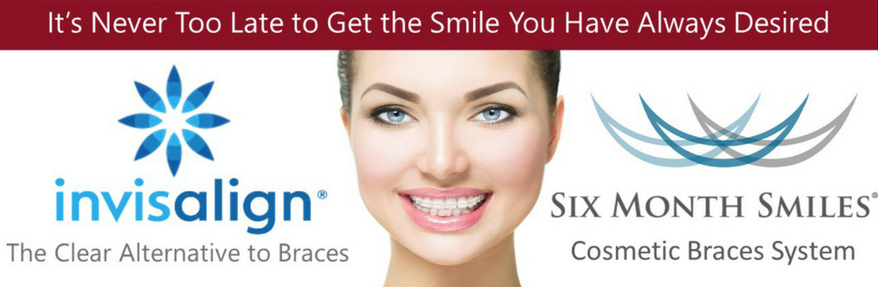 Invisalign banner with image of a woman face in the middle