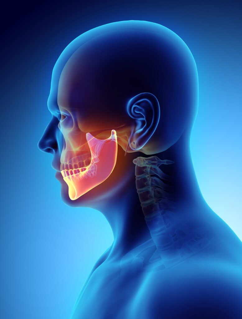 Dental Cavitation & Jawbone Infection Aria Dental