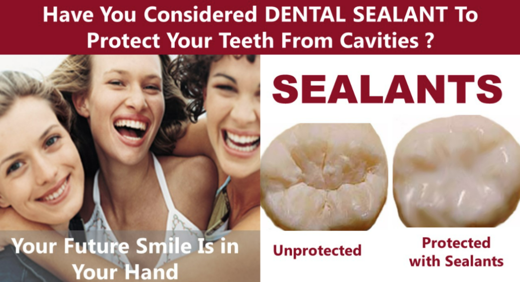 Unprotected and protected with Sealants teeth with image of three woman laughing on the left