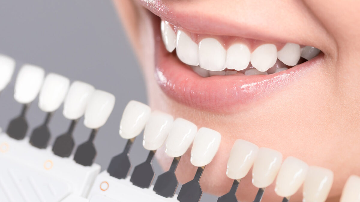 What California Should Know About Cosmetic Dentistry in 2023
