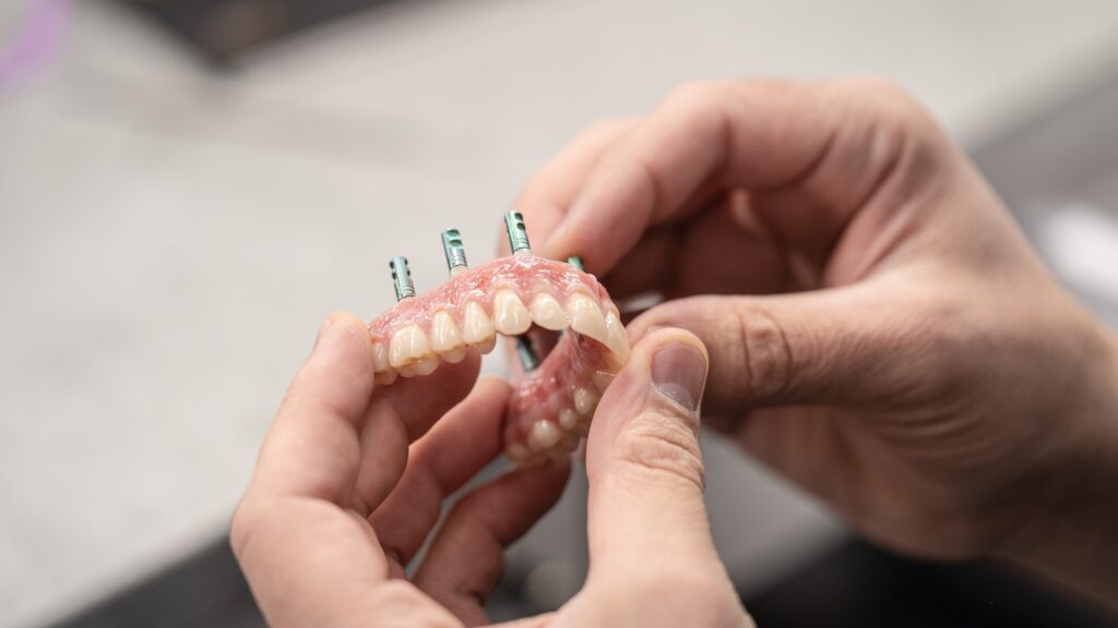 Attractiveness, Health, Self-esteem, and Intimacy, All On 4 Implants For The Spring Of Your Smile in 2022