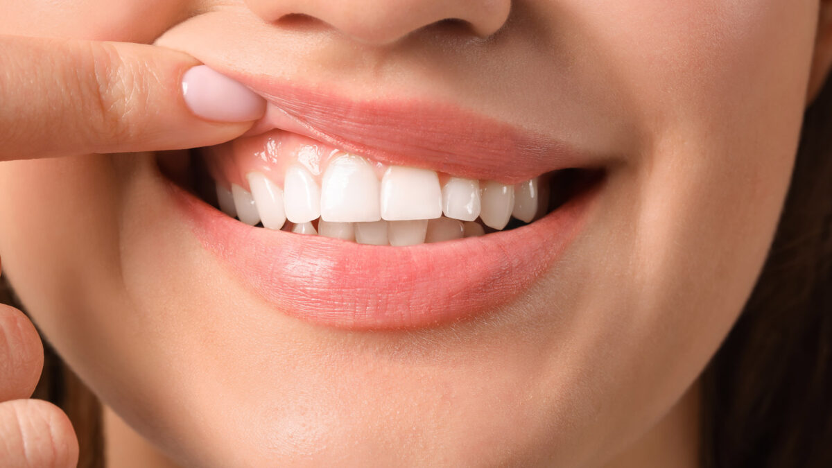 8 Ways to Beat the Defects Around Your Teeth