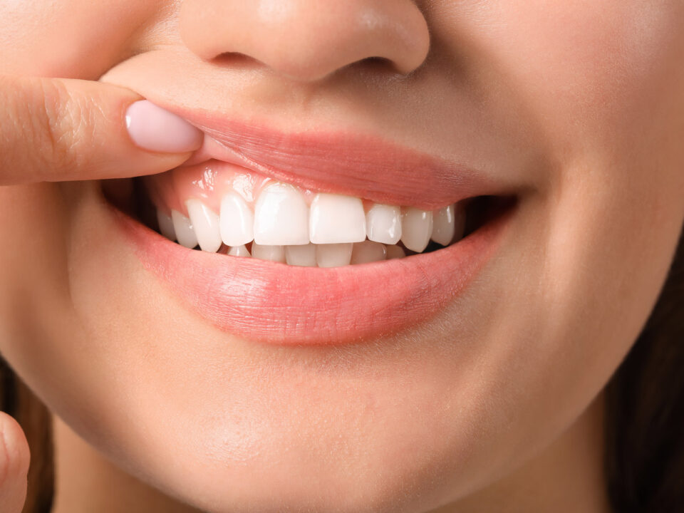 8 Ways to Beat the Defects Around Your Teeth