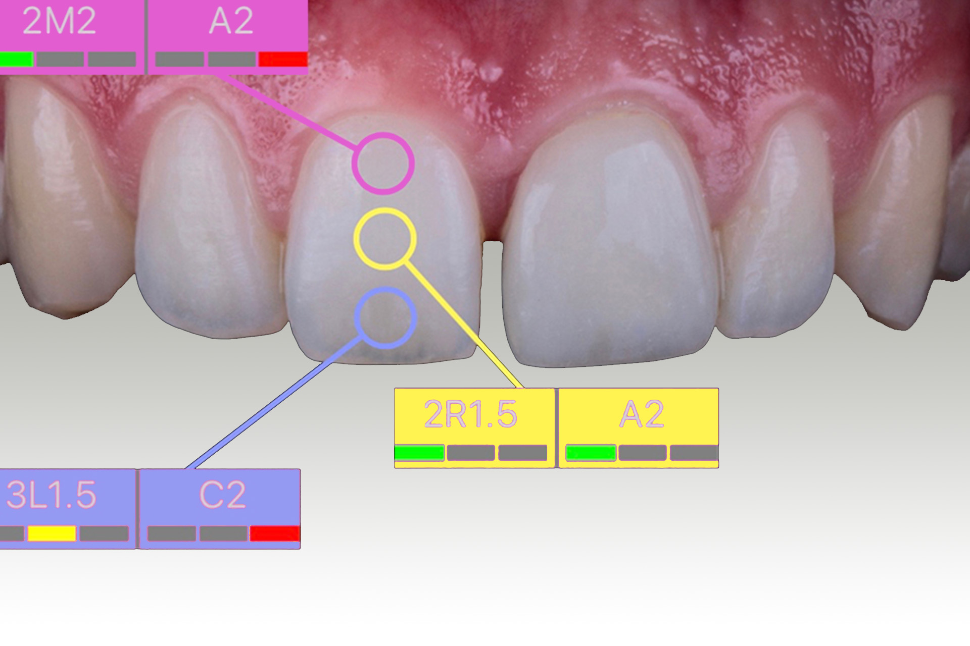 digital examination of tooth