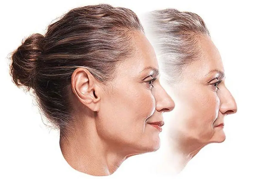 before and after of Antiaging & Rejuvenation service on a woman face
