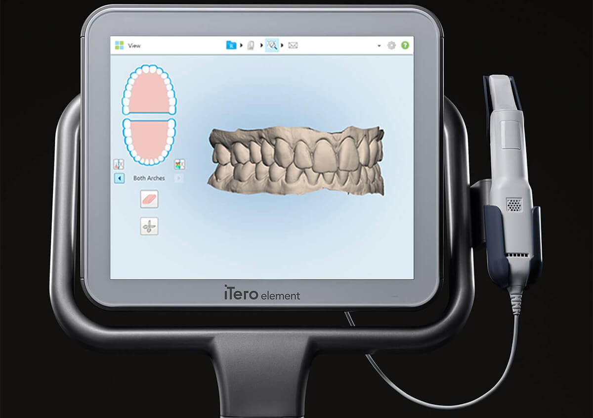 Zirconia Crown – Natural, Metal-Free, and Long-Lasting Smile Restoration
