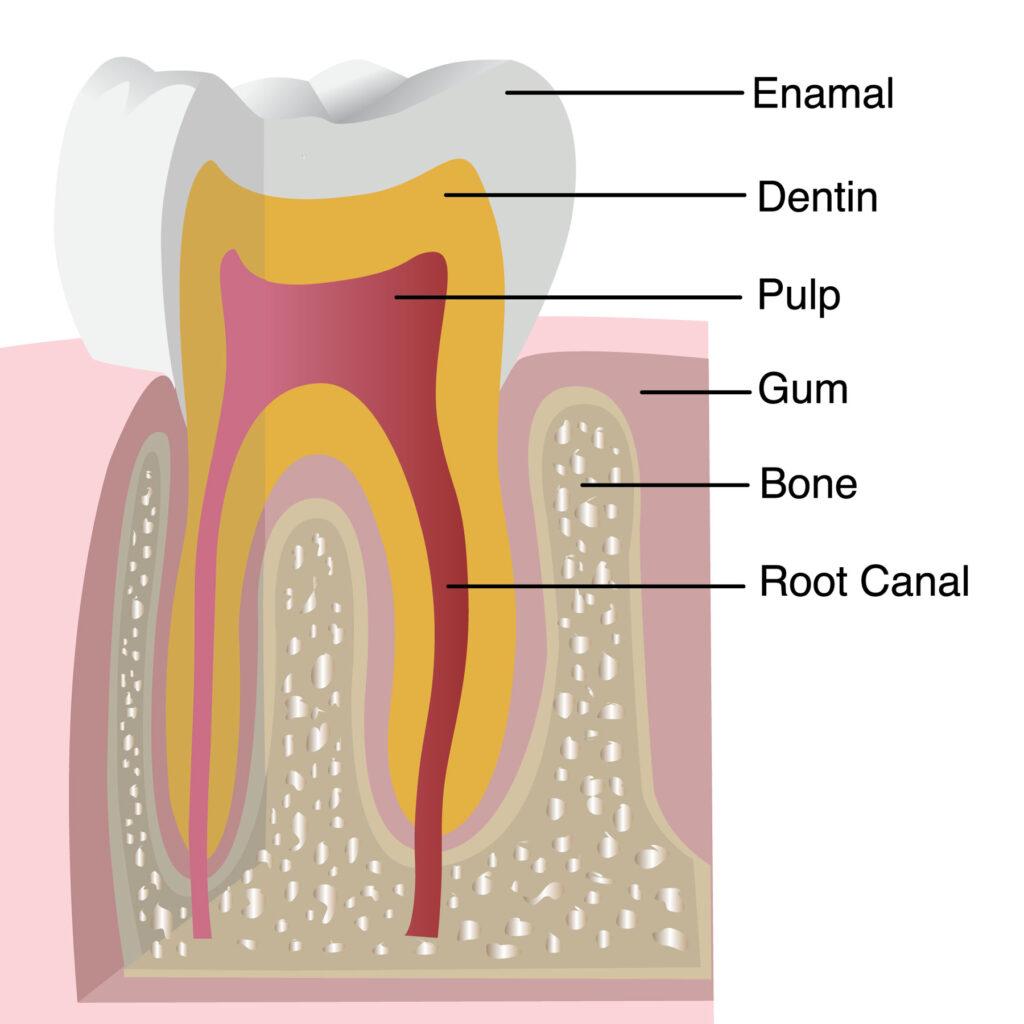 Causes and Treatments of Enamel Erosion