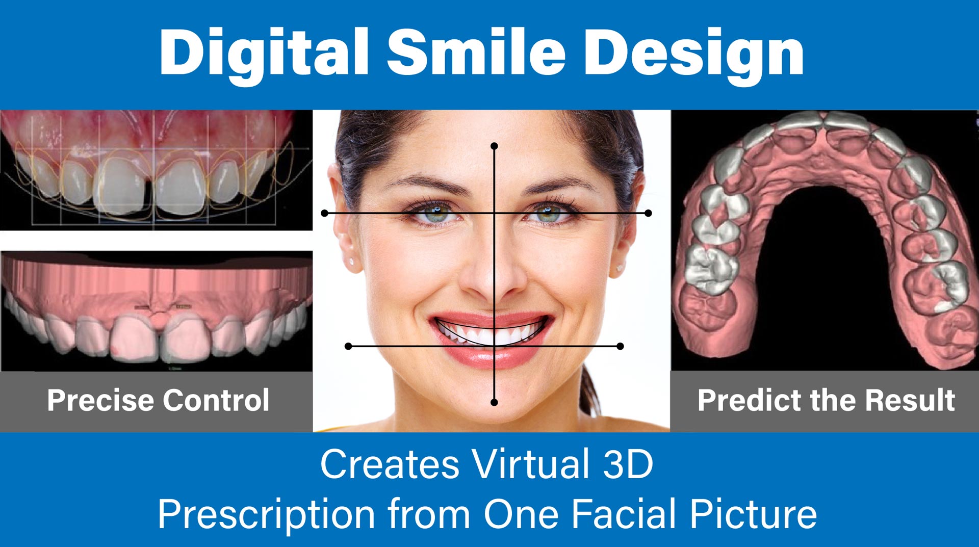 Digital Smile Design via creating Virtual 3D Prescription from on facial picture