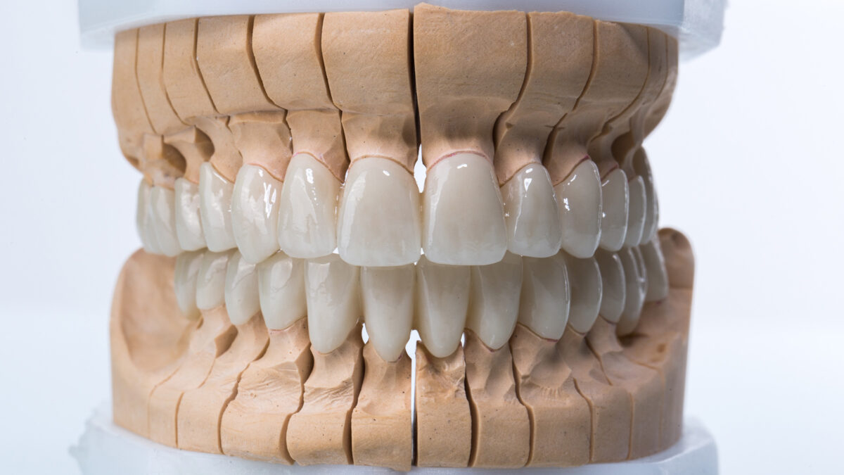 zirconia dental implants