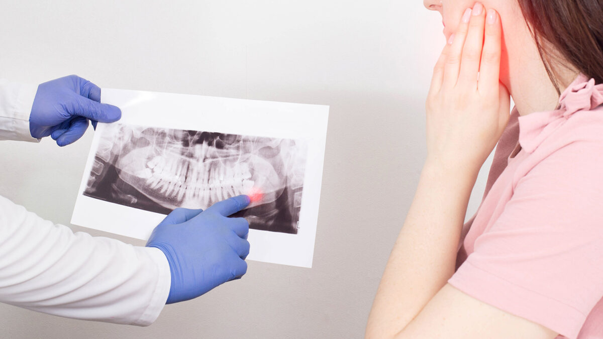 Benefits of Wisdom Teeth Extraction with L-PRF And Ozone Therapy