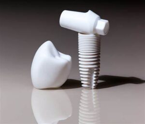 Zirconia vs Titanium Implants; Why You Should Choose Zirconia Implant!