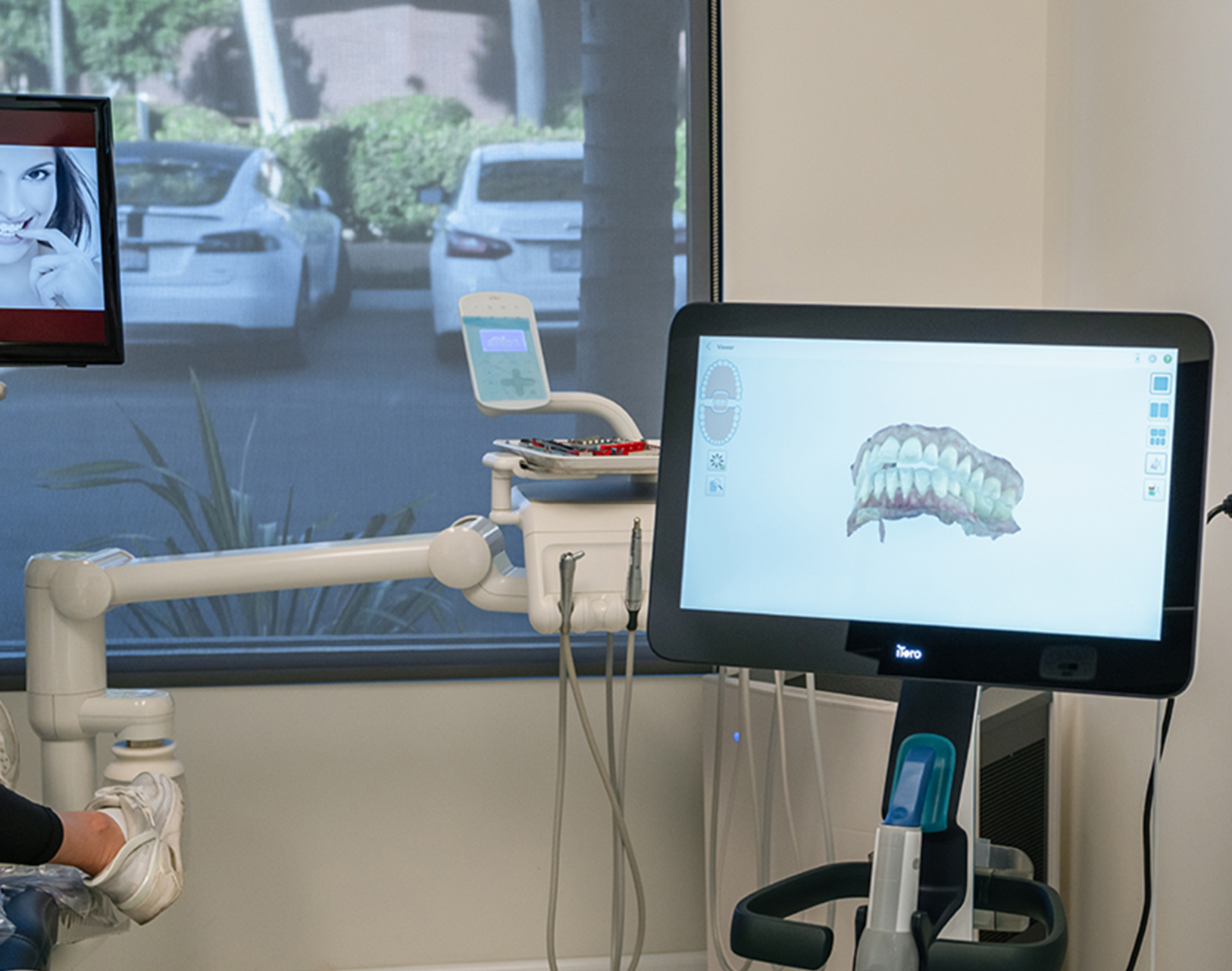 3D Dental Scan device at Aria Dental