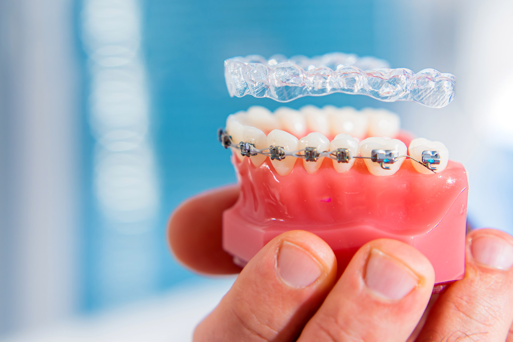 Dentist in Los Angeles Says Straight Teeth Mean Better Health