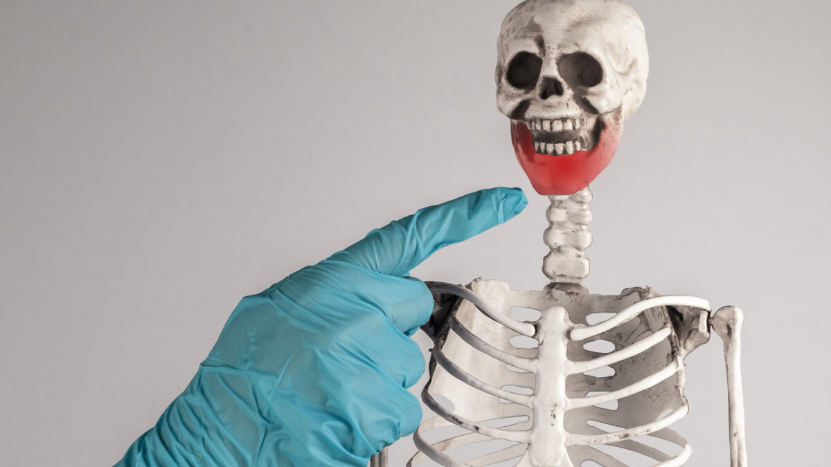 How to Prevent Cavitation (Jawbone Infection) & Dry Socket During Wisdom Teeth Extractions