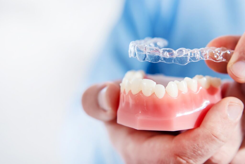 Invisible Braces: A Revolutionary Method for Orthodontics