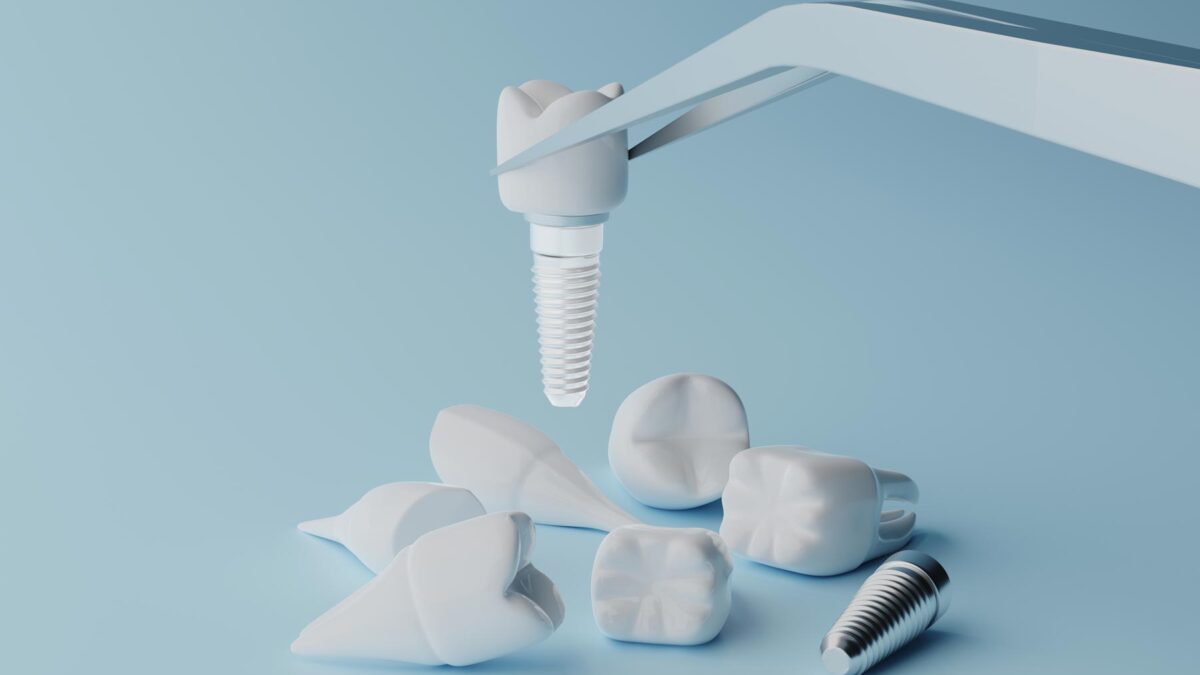 image of a zirconia implant model