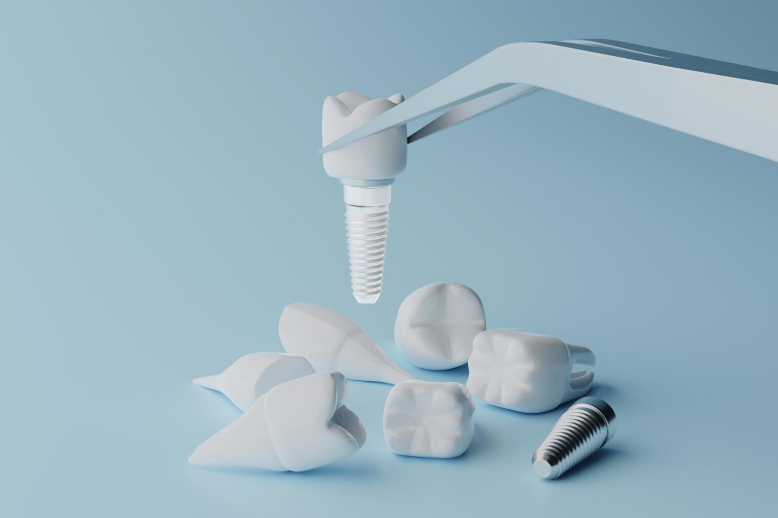 Problems with Zirconia Implants Aria Dental