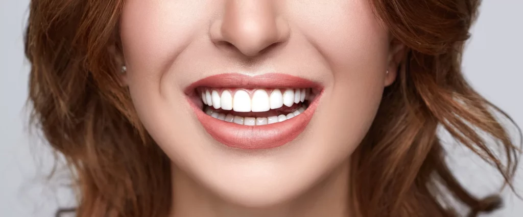 Cosmetic Dental Treatments: From Whitening to Veneers 4 image of an Aria Dental patient after cosmetic procedure