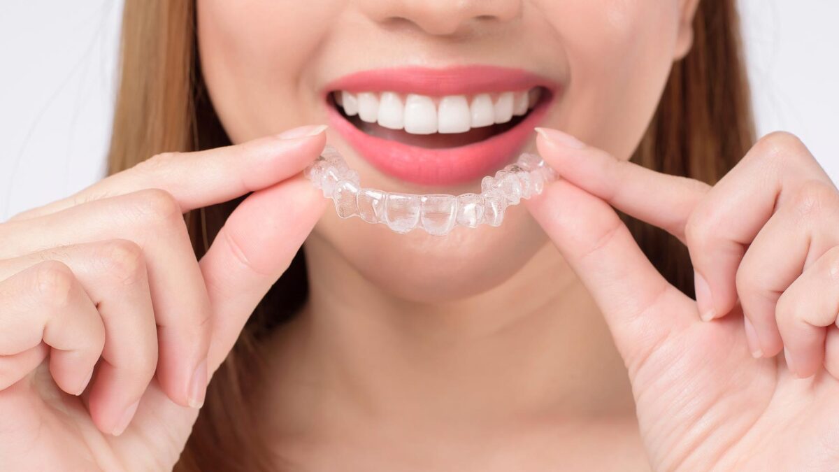 The Full Process of Invisalign Treatment