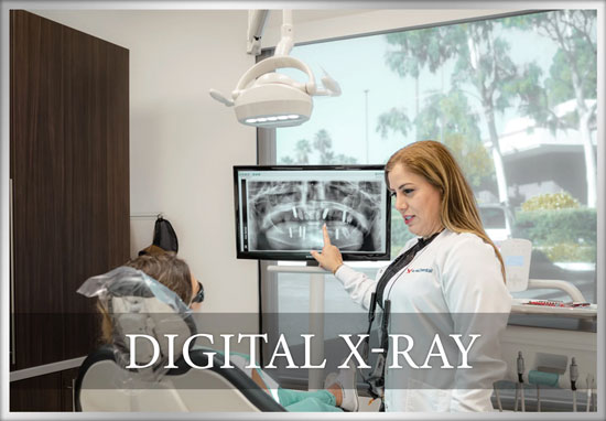Zirconia Teeth Implants | Premium Metal-Free Dental Implants in Mission Viejo, CA 8 Digital-x-ray
