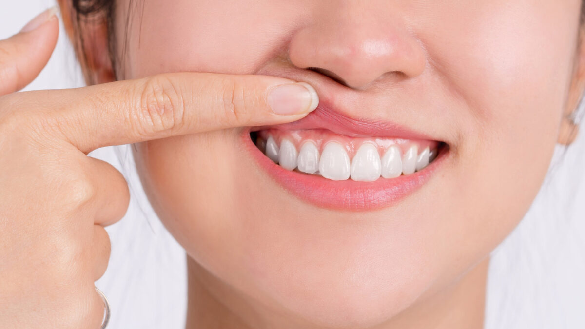 woman showing her gums with her pointing finger