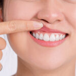 woman showing her gums with her pointing finger