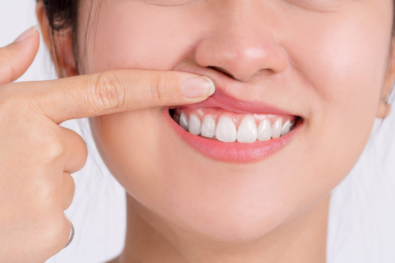 woman showing her gums with her pointing finger