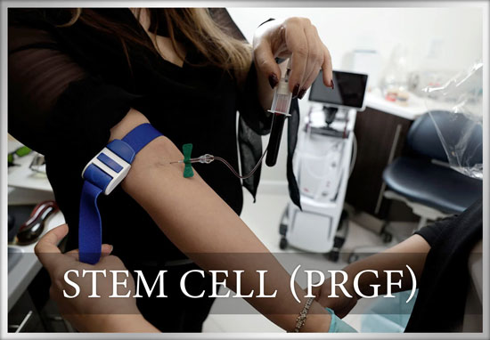 Zirconia Teeth Implants | Premium Metal-Free Dental Implants in Mission Viejo, CA 10 STEM-CELL-PRGF