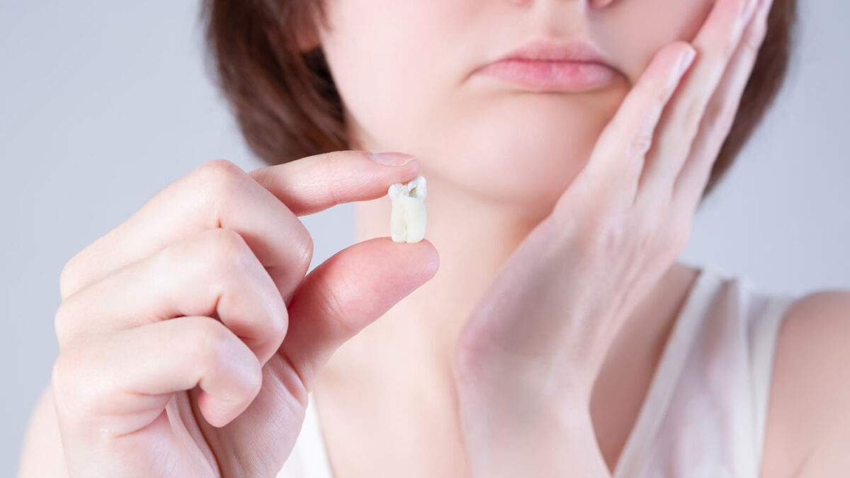 What Are the Dos and Don'ts After Wisdom Tooth Extraction?