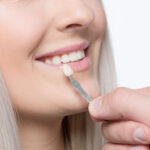 Veneers vs. Lumineers; Every Difference Explained