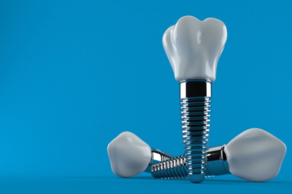 Dental Implants During Pandemic