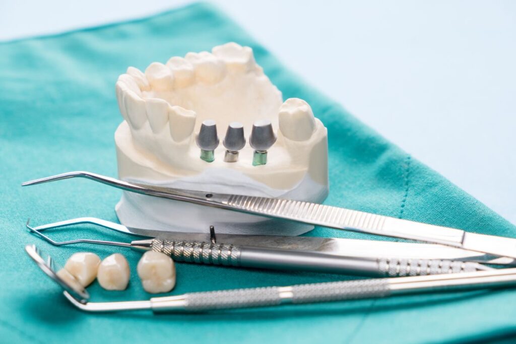 oral galvanism - zirconia dental implants