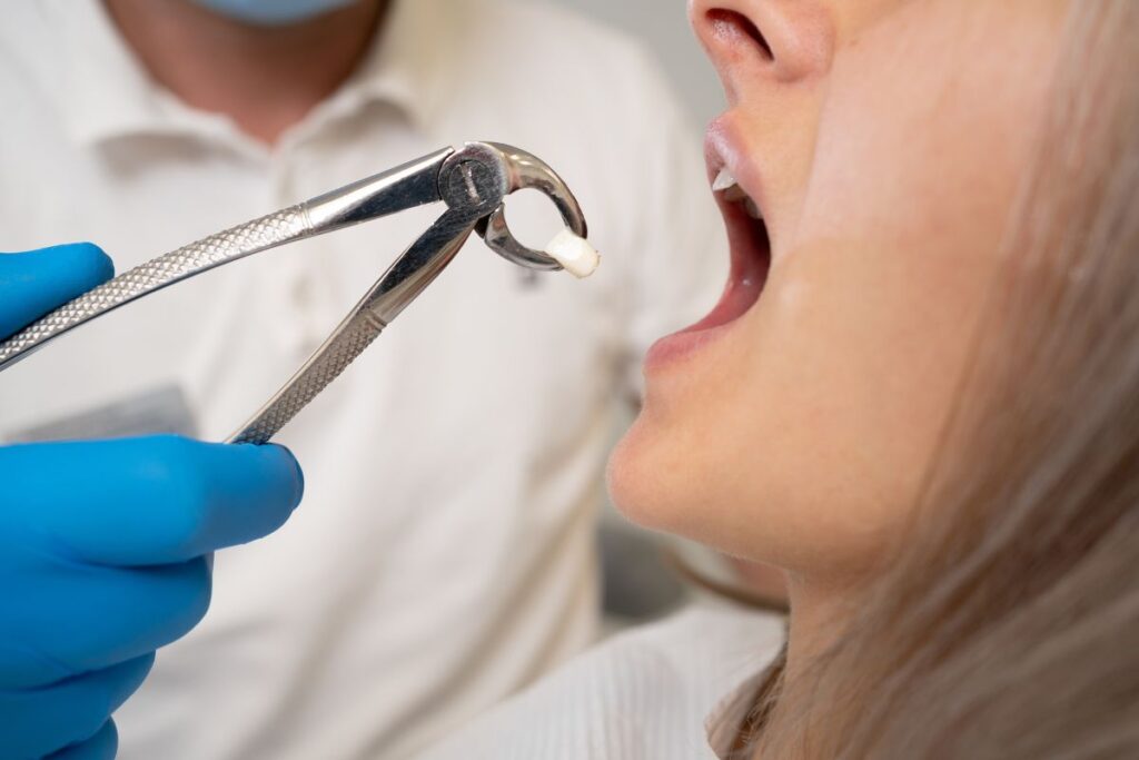 oral galvanism - Tooth extraction 