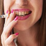 How to Deal with Smoking Stains on Teeth? 5 How to Deal with Smoking Stains on Teeth?