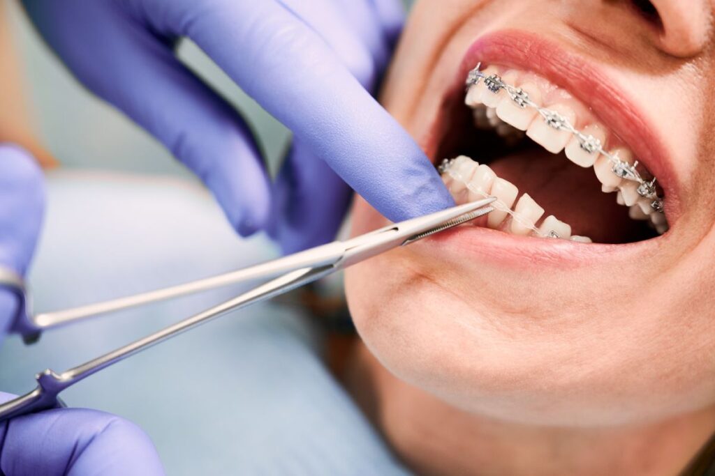 Dentist vs. Orthodontist - what does an orthodontist do?