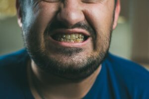 Smoking and Oral Health: Unveiling the Dark Side of Smoking on Your Smile