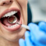 Alternatives to Lingual Braces: What You Need To Know! 4 Alternatives to Lingual braces