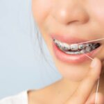 Flossing 101: How To Floss With Braces