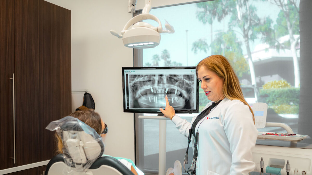 The Most Important Information You Need To Know About Dental Implants