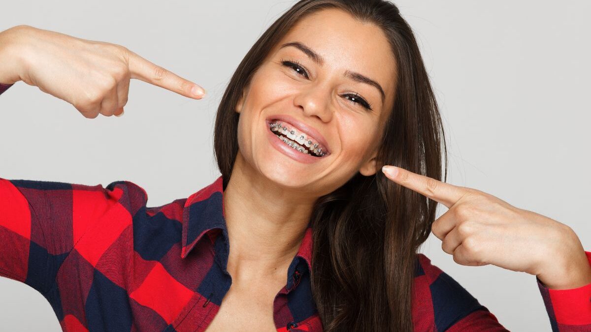 Spacers for Braces Guide: How They Work, Pain & More